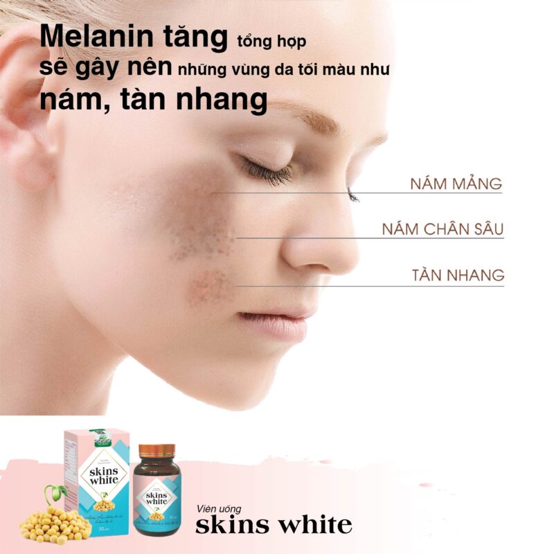 Viên uống Skins White