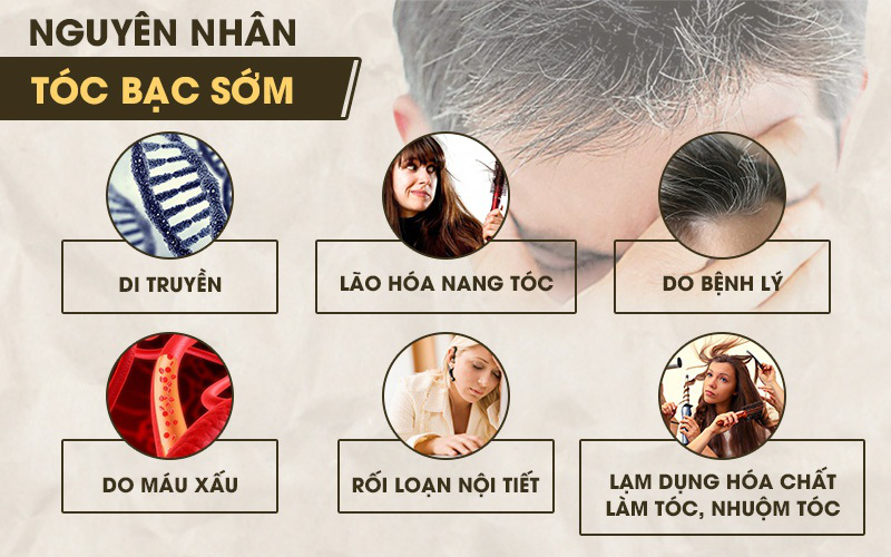 Nguyên nhân tóc bạc sớm